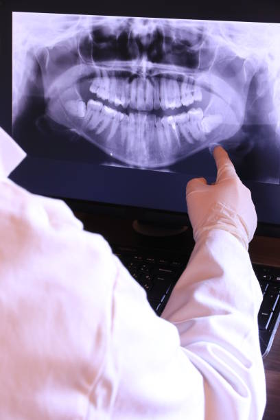 Best Broken or Chipped Tooth Repair in Varnell, GA